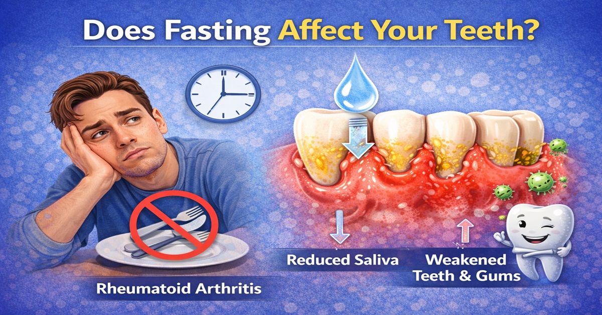 Does Fasting Affect Your Teeth