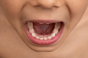 Tooth Growth Lag