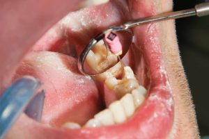 Endodontic Care