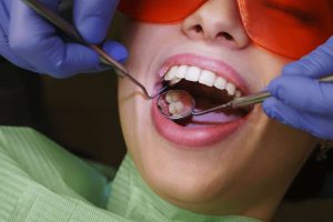 Oral Surgery (1)