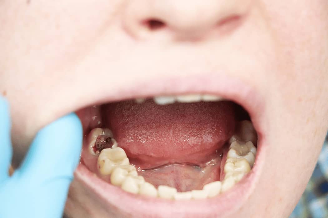 Sedation Dentistry (1)