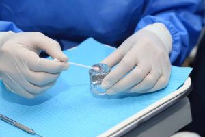 Fluoride Treatment (1)