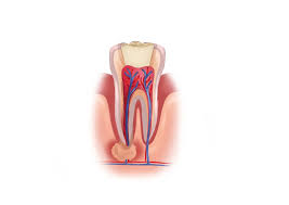 A tooth displayed, emphasizing oral hygiene after a root canal.
