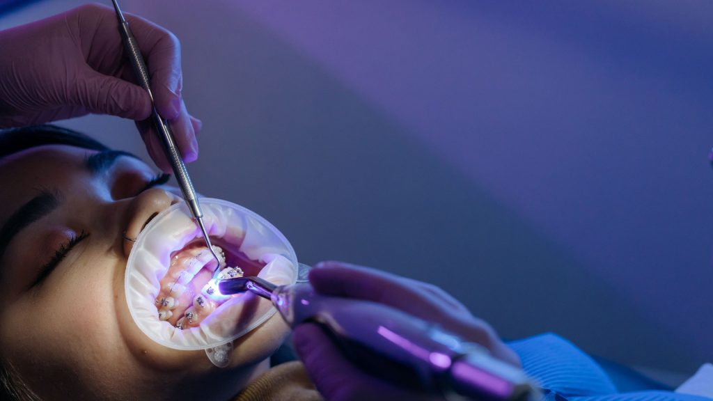 different types of dental sedation