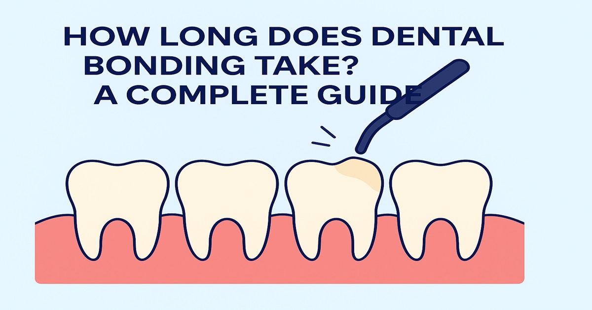 How Long Does Dental Bonding Take A Complete Guide