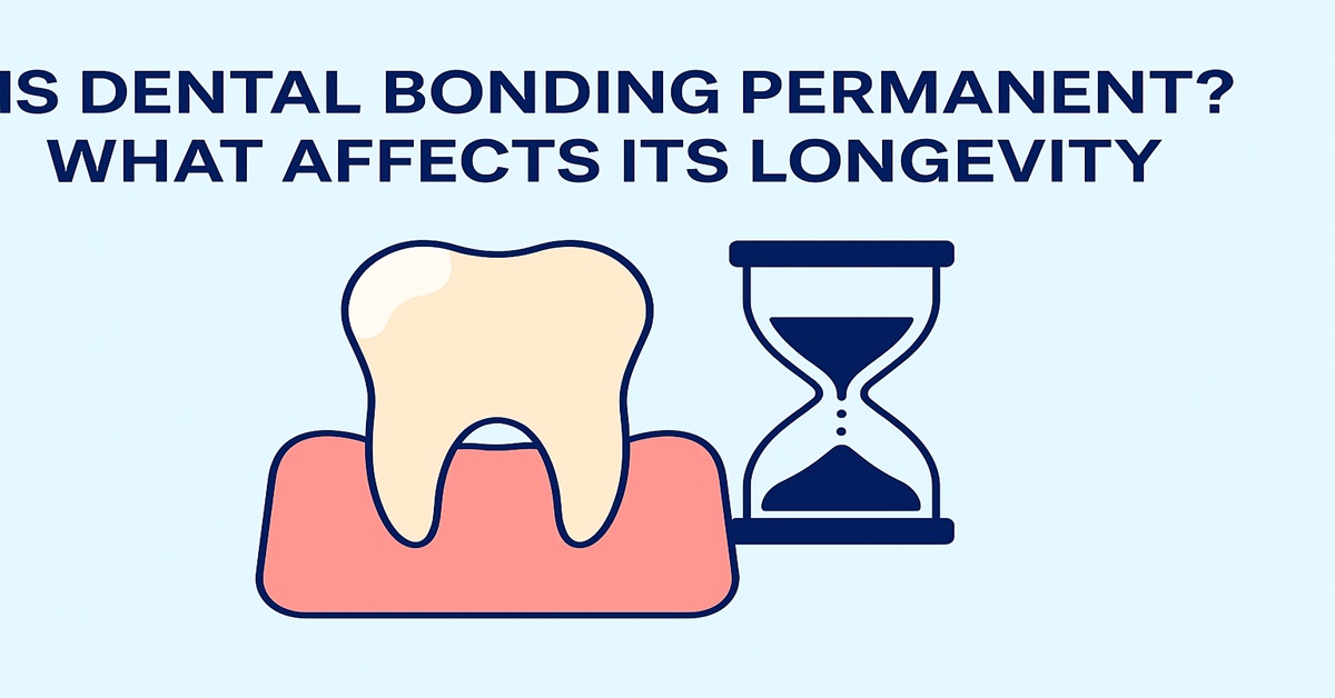 Is Dental Bonding Permanent What Affects Its Longevity