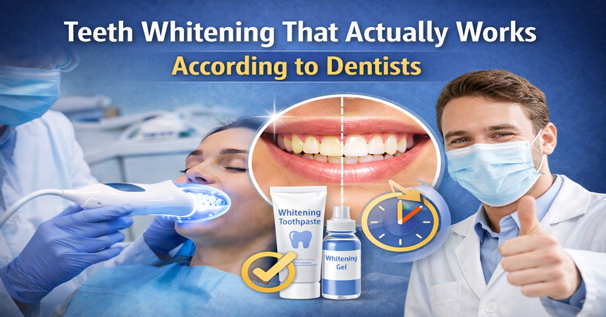 Teeth Whitening That Actually Works According to Dentists