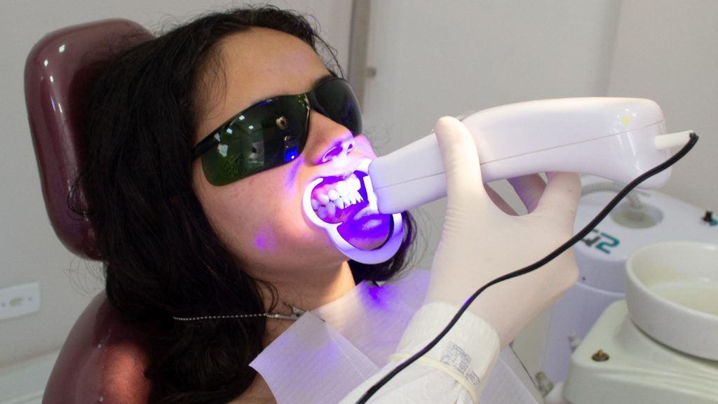 best teeth whitening for sensitive teeth