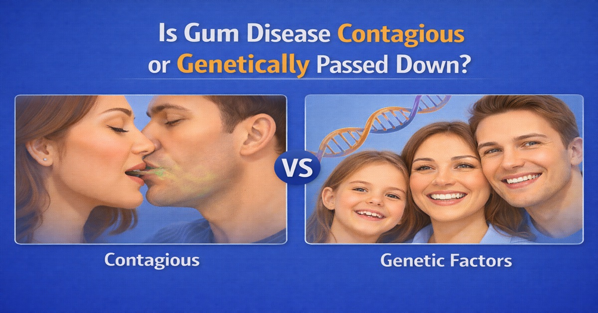 Is Gum Disease Contagious or Genetically Passed Down