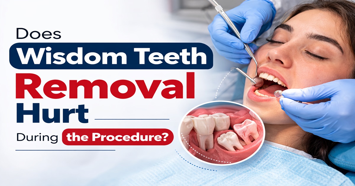 Does Wisdom Teeth Removal Hurt During the Procedure