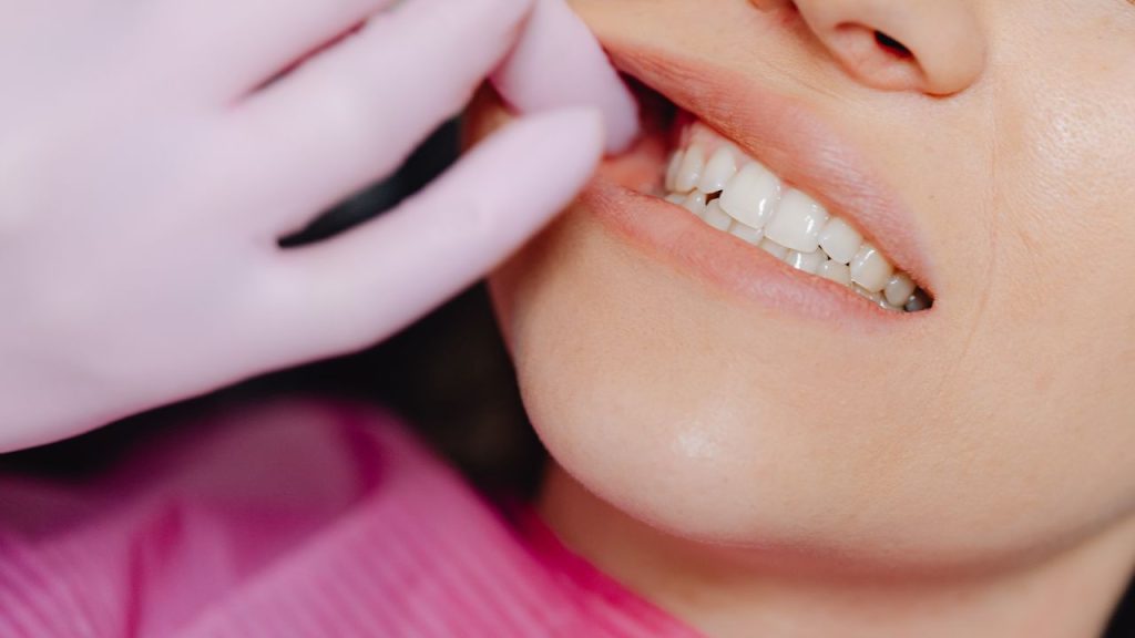 dental crown and bridge