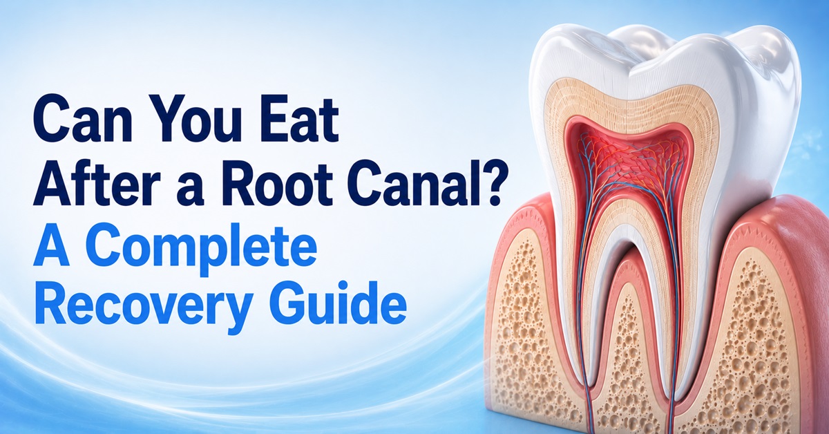 Can You Eat After a Root Canal A Complete Recovery Guide