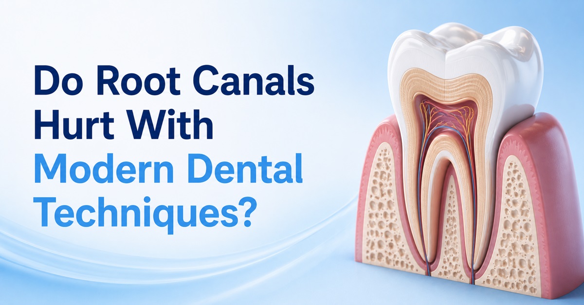 Do Root Canals Hurt With Modern Dental Techniques
