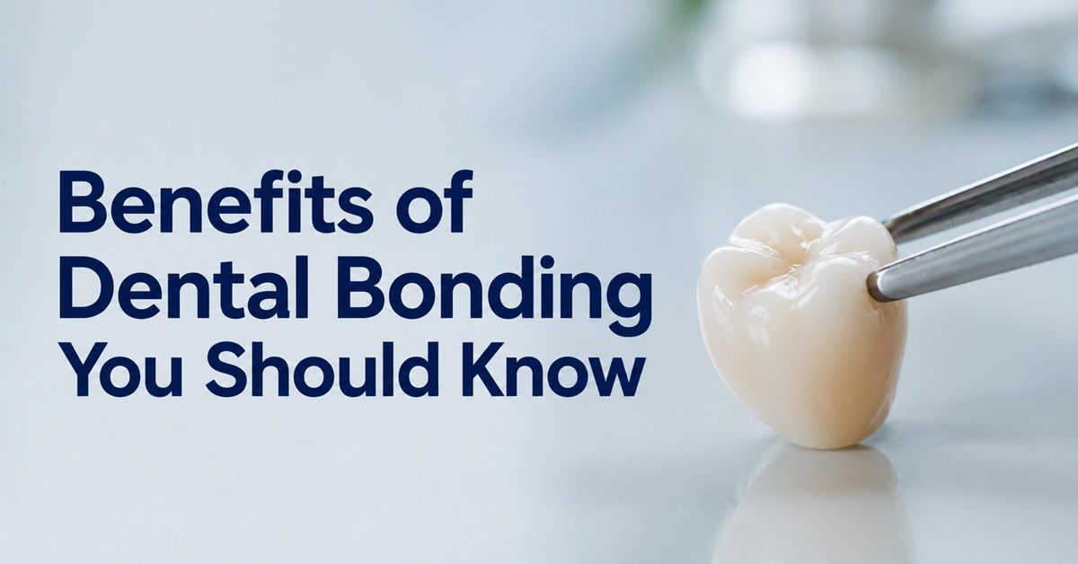 Benefits of Dental Bonding You Should Know