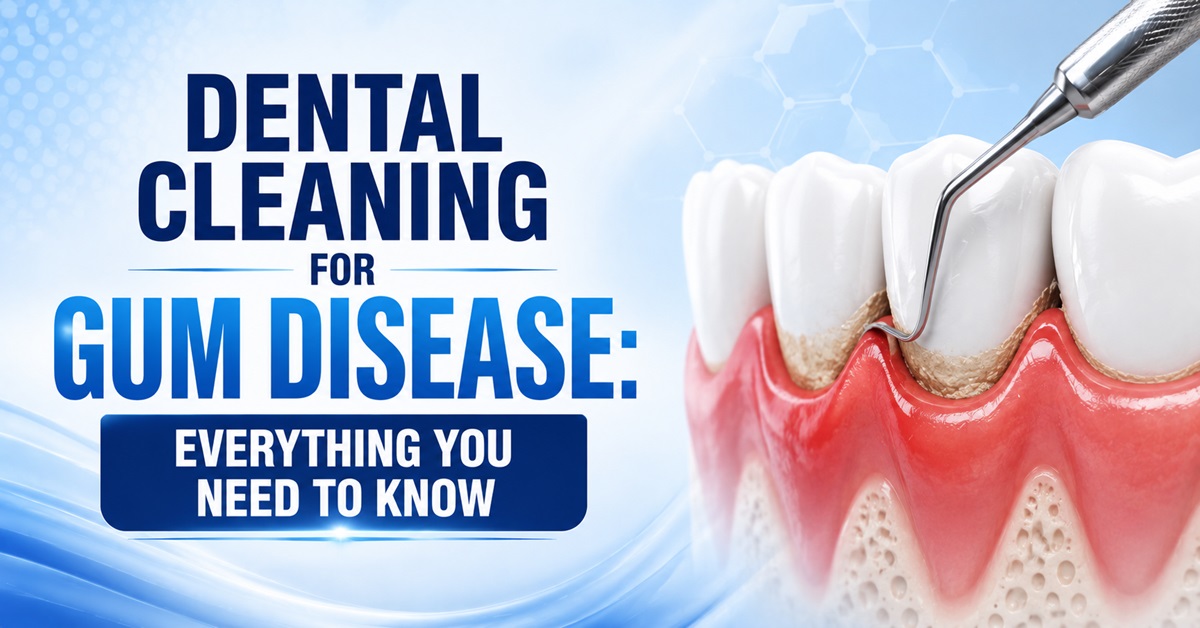 Dental Cleaning for Gum Disease Everything You Need to Know