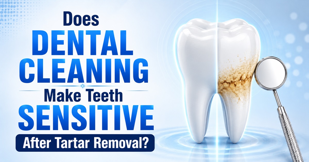 Does Dental Cleaning Make Teeth Sensitive After Tartar Removal