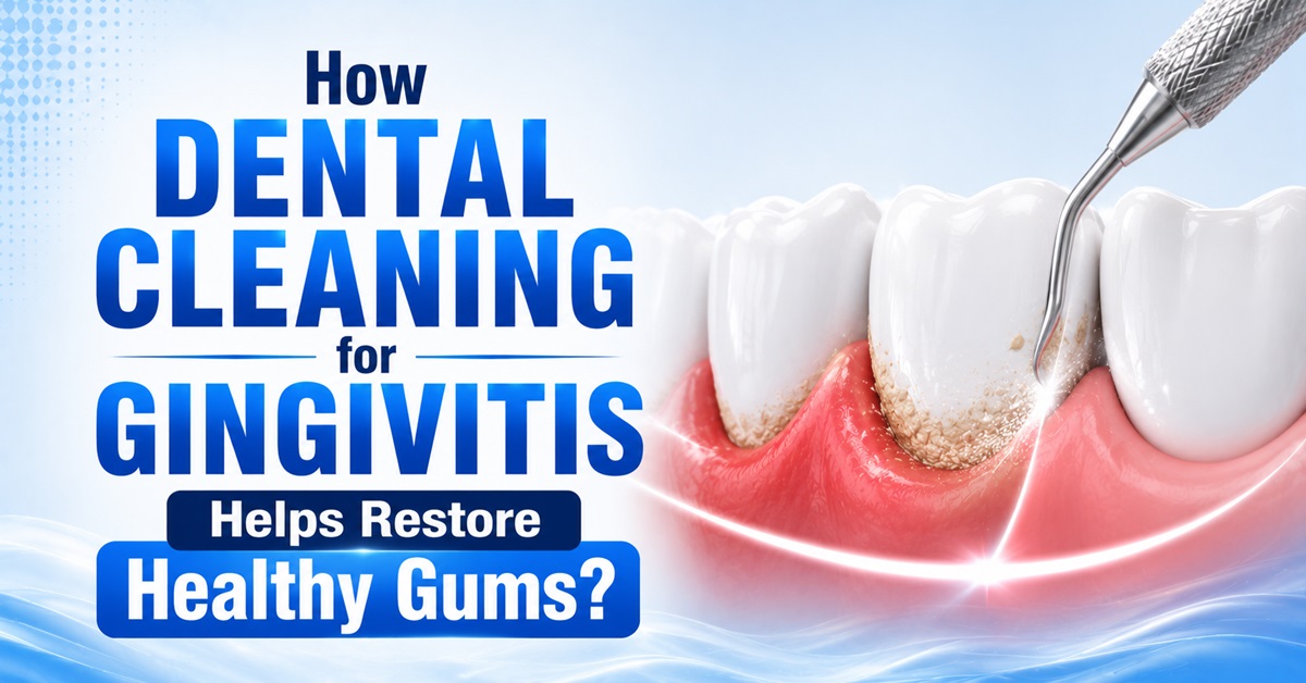 How Dental Cleaning for Gingivitis Helps Restore Healthy Gums