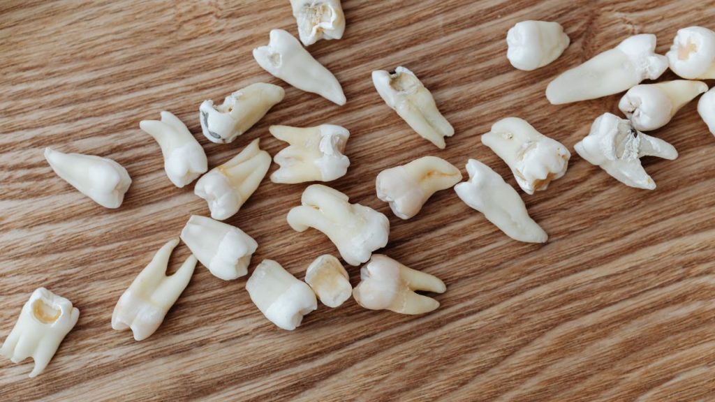 dental cleaning for gingivitis