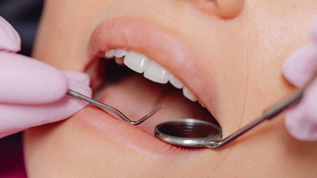 how long after a dental cleaning can i eat